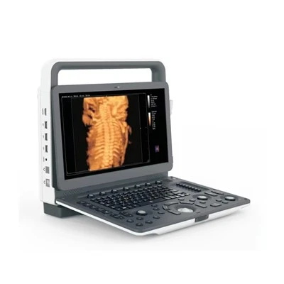 Zonecare M30 15.6 Pous Portable Koulè Doppler Ultrason Machine